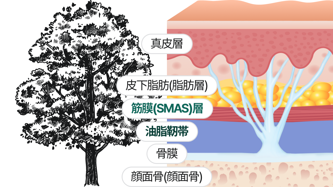 真皮層、皮下脂肪（脂肪層）、筋膜(SMAS)、支持靭帯、骨膜、顔面骨（顔の骨）