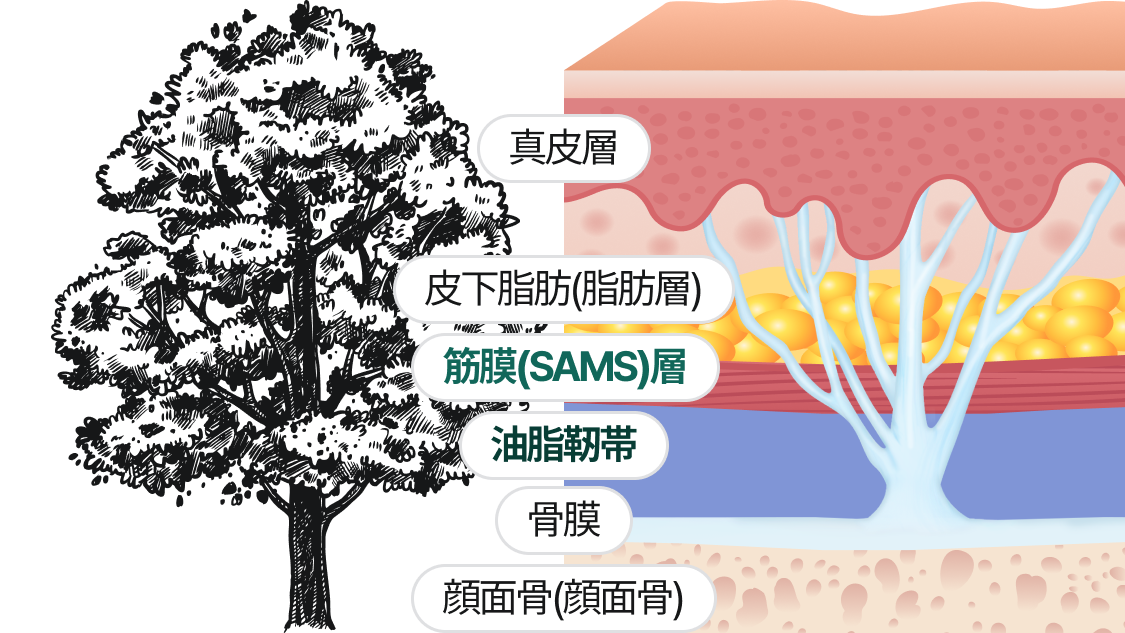 真皮層、皮下脂肪（脂肪層）、筋膜(SAMS)、支持靭帯、骨膜、顔面骨（顔の骨）