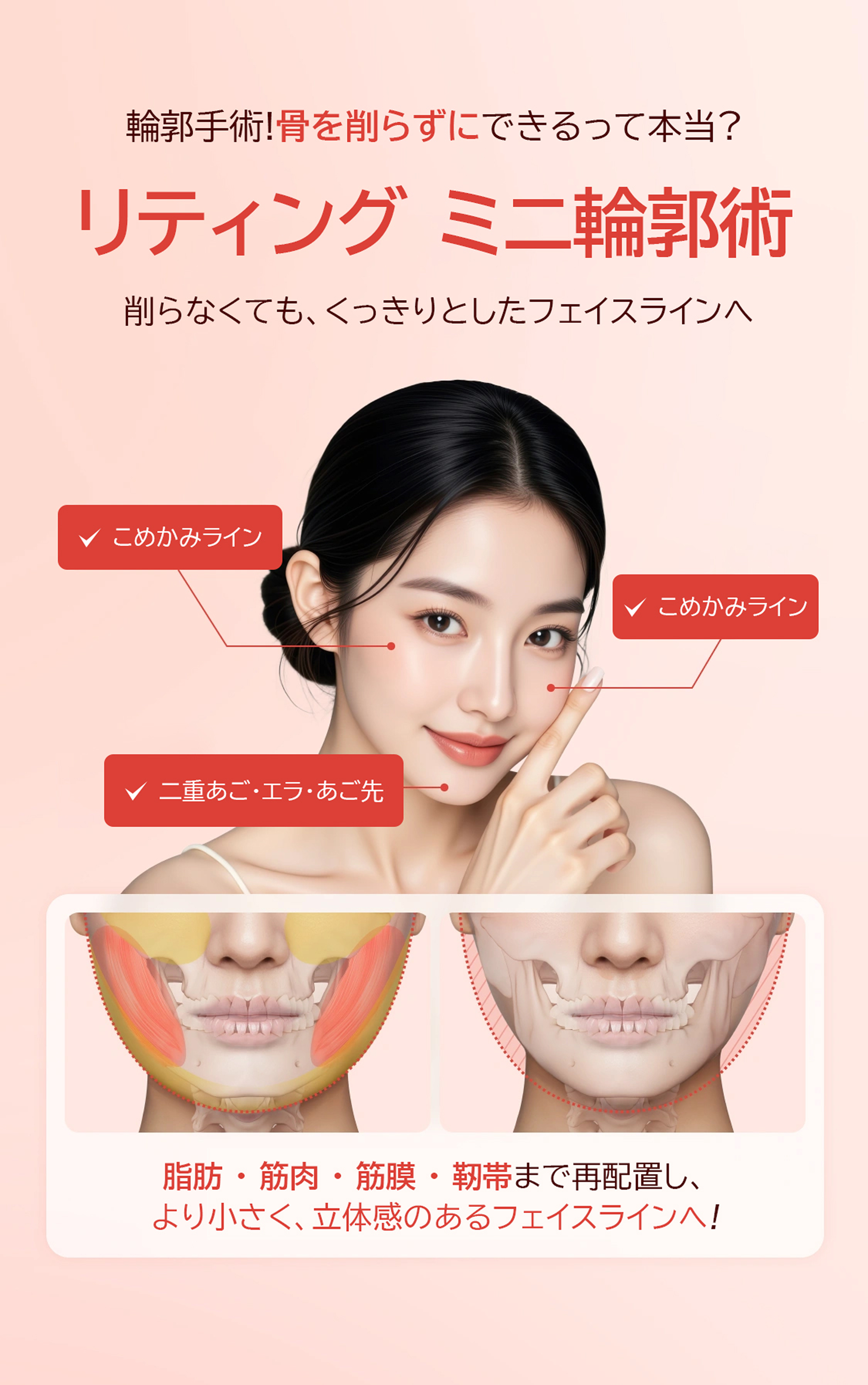 Lifting Mini Facial Contouring Surgery